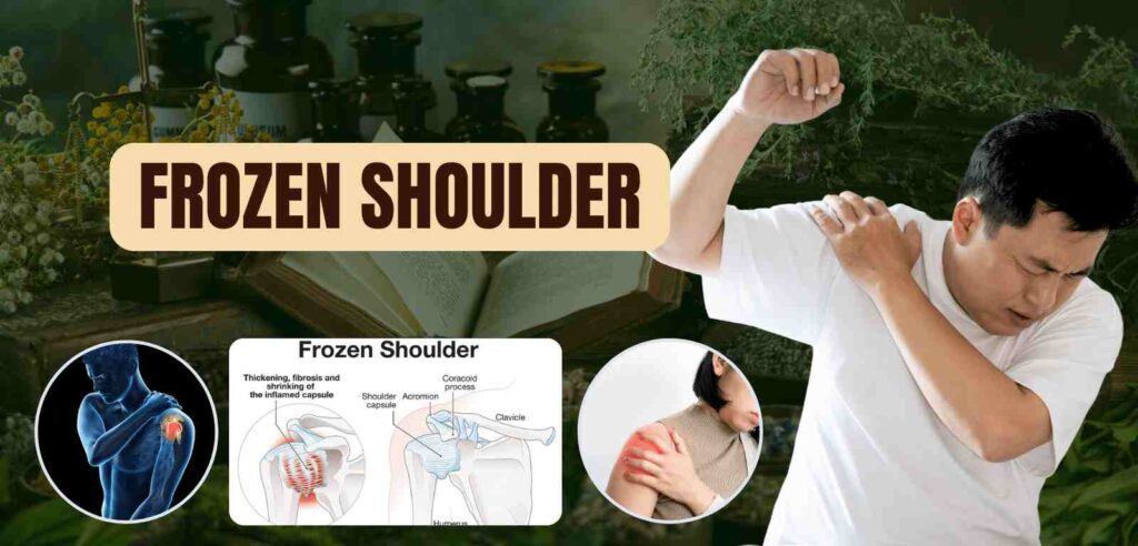 Frozen Shoulder 1 Frozen Shoulder