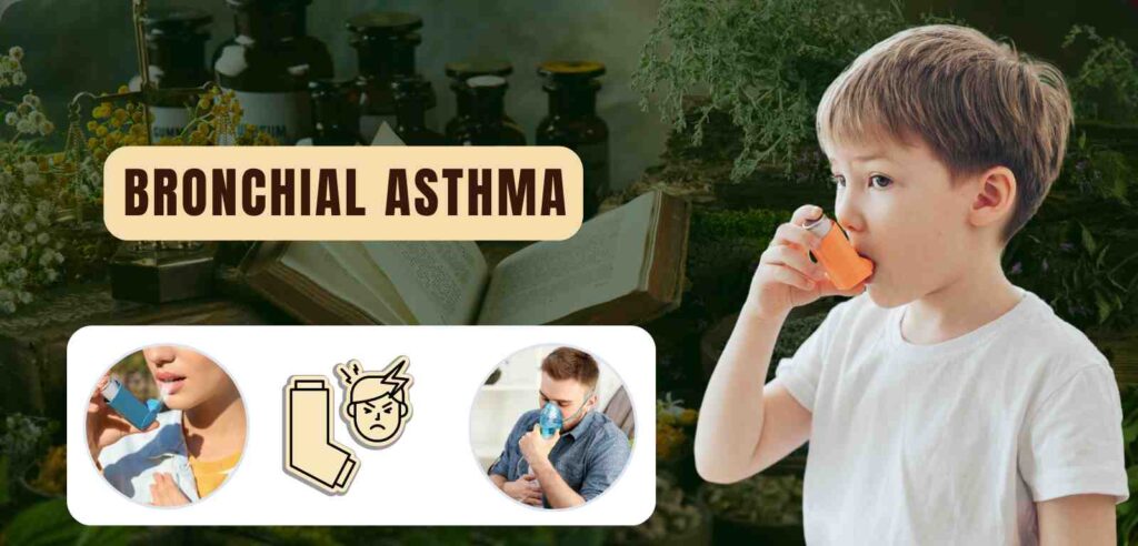 Bronchial Asthma 1 Bronchial Asthma