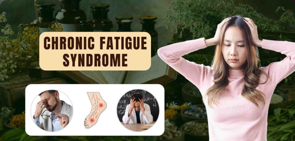Chronic Fatigue Syndrome 1 Chronic Fatigue Syndrome