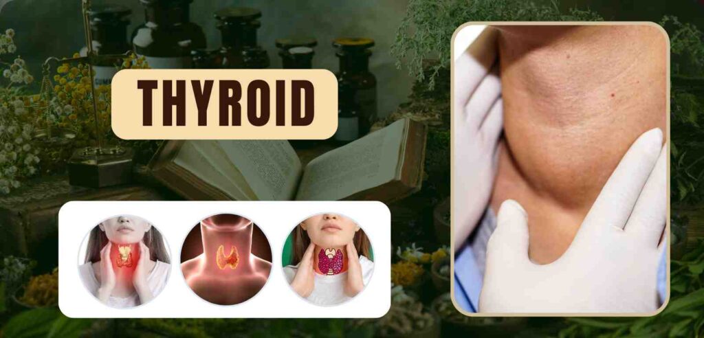 Thyroid 1 Thyroid