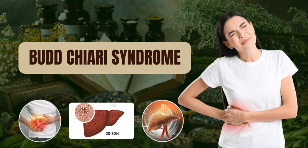 Budd Chiari Syndrome