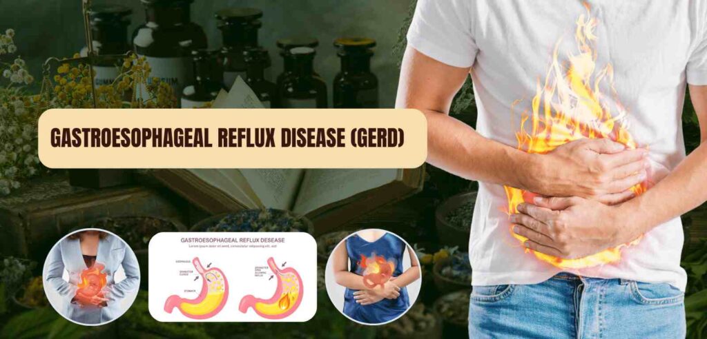 Gastroesophageal Reflux Disease (GERD)